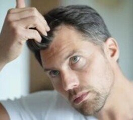 Hair Loss