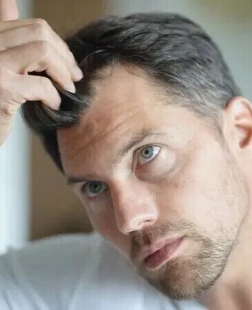 Hair Loss